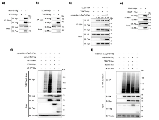 Fig. 7 calpain2a inhibits TRAF6-mediated ubiquitination of ECSIT and BECN1. a HEK293 cells were transfected with ECSIT-Myc, TRAF6-Flag, or empty vector. After 24 h post-transfection, the cells were lysed and IP analyzed with Flag antibody. b HEK293 cells were transfected with TAK1-Flag, ECSIT-Myc, or empty vector. After 24 h post-transfection, the cells were lysed and IP analyzed with Myc antibody. c HEK293 cells were transfected with TRAF6-Myc, ECSIT-HA, empty vector, or different concentrations of calpain2a-ΔCysPc-Flag. After 24 h post-transfection, the cells were lysed and IP analyzed with Myc antibody. d HEK293 cells were cotransfected with ECSIT-Myc, TRAF6-HA, WT-ubiquitin-His together with calpain2a-Flag, calpain2a-ΔCysPc-Flag or empty vector. After 24 h post-transfection, the cells were lysed and purified with Ni-NTA agarose. e HEK293 cells were transfected with BECN1-Flag, TRAF6-Myc, or empty vector. After 24 h post-transfection, the cells were lysed and IP analyzed with Myc antibody. f HEK293 cells were cotransfected with BECN1-HA, TRAF6-Myc, WT-ubiquitin-His together with calpain2a-Flag, calpain2a-ΔCysPc-Flag or empty vector. After 24 h post-transfection, the cells were lysed and purified with Ni-NTA agarose. The immunoprecipitates and inputs with anti-Myc, anti-Flag, anti-HA, and anti-Tubulin Abs. All experiments were performed in at least three independent experiments. Fig. 7 calpain2a inhibits TRAF6-mediated ubiquitination of ECSIT and BECN1. a HEK293 cells were transfected with ECSIT-Myc, TRAF6-Flag, or empty vector. After 24 h post-transfection, the cells were lysed and IP analyzed with Flag antibody. b HEK293 cells were transfected with TAK1-Flag, ECSIT-Myc, or empty vector. After 24 h post-transfection, the cells were lysed and IP analyzed with Myc antibody. c HEK293 cells were transfected with TRAF6-Myc, ECSIT-HA, empty vector, or different concentrations of calpain2a-ΔCysPc-Flag. After 24 h post-transfection, the cells were lysed and IP analyzed with Myc antibody. d HEK293 cells were cotransfected with ECSIT-Myc, TRAF6-HA, WT-ubiquitin-His together with calpain2a-Flag, calpain2a-ΔCysPc-Flag or empty vector. After 24 h post-transfection, the cells were lysed and purified with Ni-NTA agarose. e HEK293 cells were transfected with BECN1-Flag, TRAF6-Myc, or empty vector. After 24 h post-transfection, the cells were lysed and IP analyzed with Myc antibody. f HEK293 cells were cotransfected with BECN1-HA, TRAF6-Myc, WT-ubiquitin-His together with calpain2a-Flag, calpain2a-ΔCysPc-Flag or empty vector. After 24 h post-transfection, the cells were lysed and purified with Ni-NTA agarose. The immunoprecipitates and inputs with anti-Myc, anti-Flag, anti-HA, and anti-Tubulin Abs. All experiments were performed in at least three independent experiments.